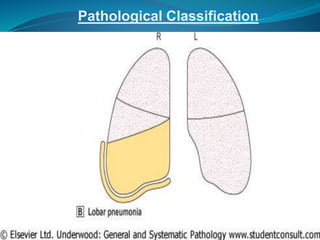 Pathological Classification
 