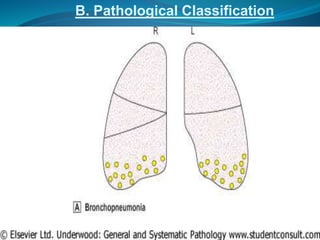 B. Pathological Classification
 