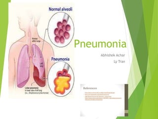 Pneumonia
Abhishek Achar
Ly Tran
 