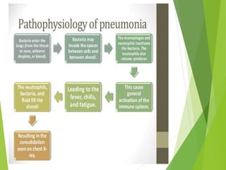 Pneumonia | PPTX