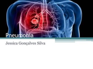 Pneumonia
Jessica Gonçalves Silva
 