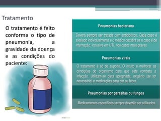 Tratamento
O tratamento é feito
conforme o tipo de
pneumonia, a
gravidade da doença
e as condições do
paciente:
 