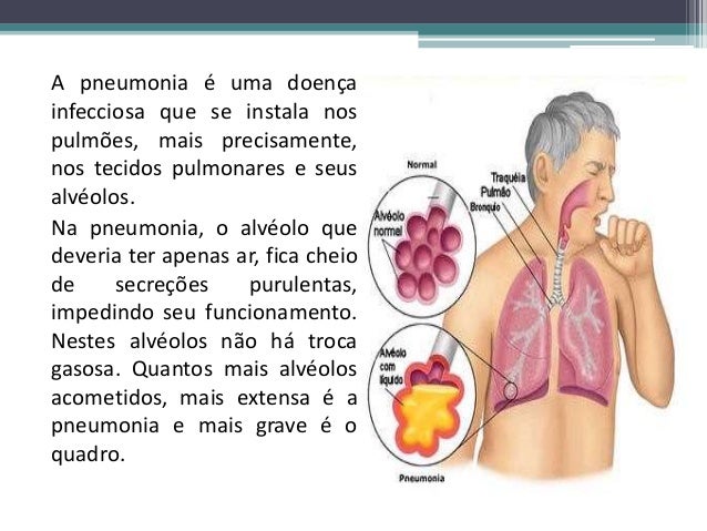 Pneumonia
