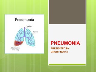 PNEUMONIA
PRESENTED BY
GROUP NO # 3
 