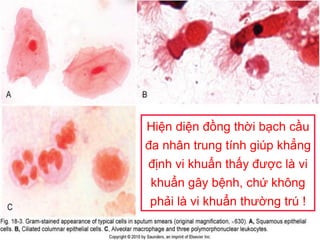 Hiện diện đồng thời bạch cầu
đa nhân trung tính giúp khẳng
định vi khuẩn thấy được là vi
khuẩn gây bệnh, chứ không
phải là vi khuẩn thường trú !
 