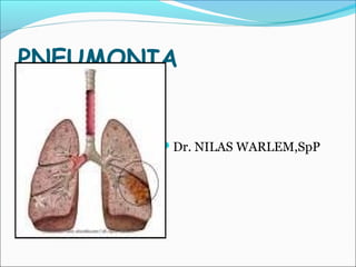 PNEUMONIA
Dr. NILAS WARLEM,SpP
 