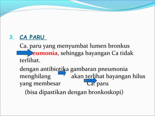 3. CA PARU
Ca. paru yang menyumbat lumen bronkus
pneumonia, sehingga bayangan Ca tidak
terlihat.
dengan antibiotika gambaran pneumonia
menghilang akan terlihat bayangan hilus
yang membesar Ca. paru
(bisa dipastikan dengan bronkoskopi)
 