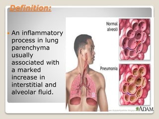 Definition:
 An inflammatory
process in lung
parenchyma
usually
associated with
a marked
increase in
interstitial and
alveolar fluid.
6/6/2018 2www.drjayeshpatidar.blogspot.com
 