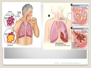 6/6/2018 3www.drjayeshpatidar.blogspot.com
 