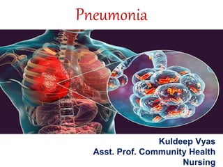 Pneumonia
Kuldeep Vyas
Asst. Prof. Community Health
Nursing
 