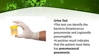 Urine Test
•This test can identify the
bacteria Streptococcus
pneumoniae and Legionella
pneumophila.
•A positive result indicates
that the patient most likely
has pneumococcal
pneumonia.
 