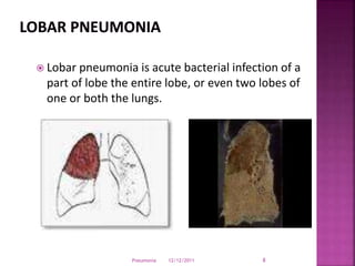  Lobar pneumonia is acute bacterial infection of a
part of lobe the entire lobe, or even two lobes of
one or both the lungs.
12/12/2011Pneumonia 8
 