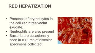 RED HEPATIZATION
• Presence of erythrocytes in
the cellular intraalveolar
exudate.
• Neutrophils are also present
• Bacteria are occasionally
seen in cultures of alveolar
specimens collected
 