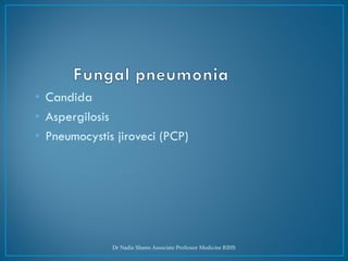 • Candida
• Aspergilosis
• Pneumocystis jiroveci (PCP)
Dr Nadia Shams Associate Professor Medicine RIHS
 