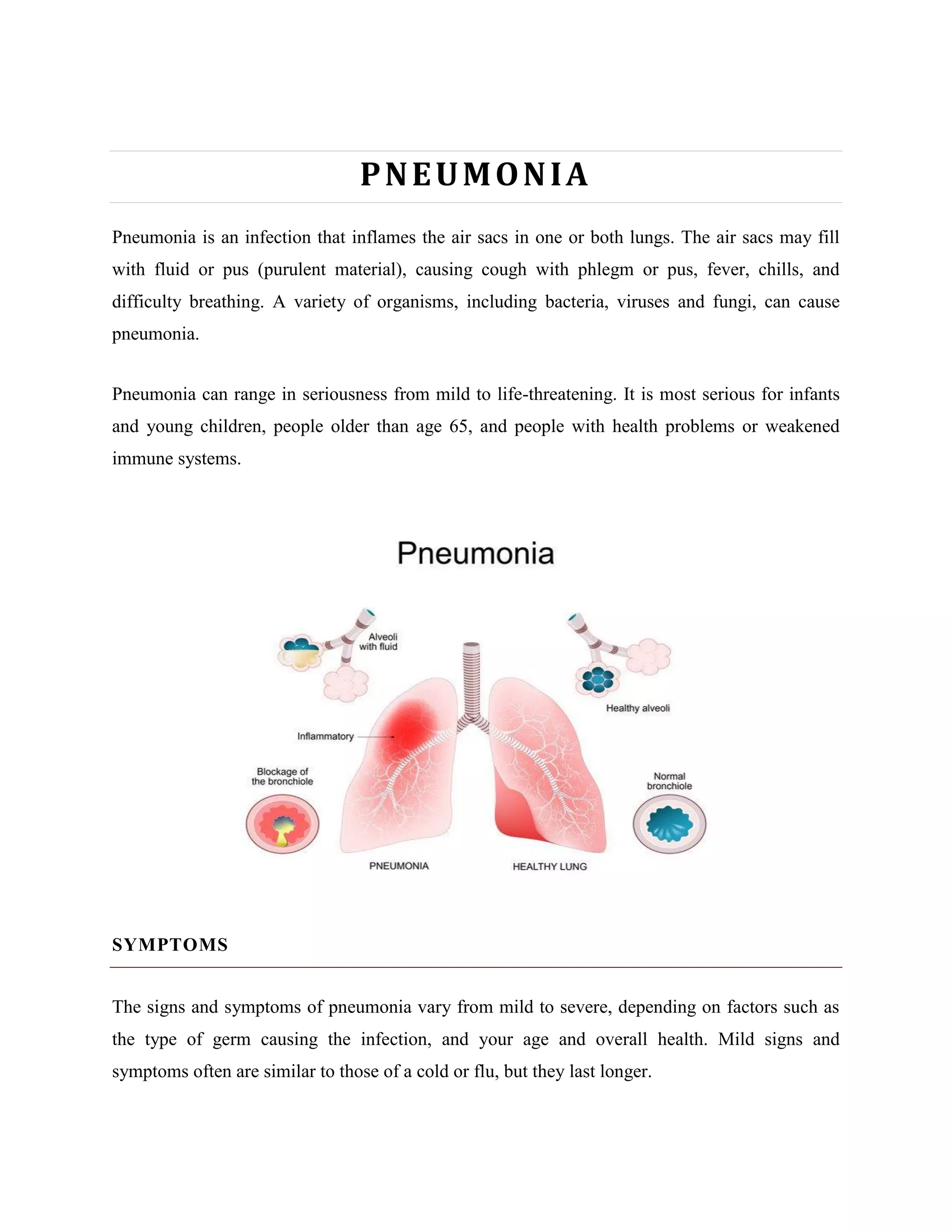 Pneumonia | PDF