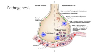 Pathogenesis
 