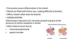 • Pneumonia causes inflammation in the alveoli
• Alveoli are filled with fluid or pus, making difficulty to breathe.
• Affects alveoli rather than the bronchi
• CONSOLIDATION:
Inflammatory induration of a normally aerated lung due to the
presence of cellular exudative in alveoli
• More Likely to occur due to:
• immunocompromised
• potent microbe
 