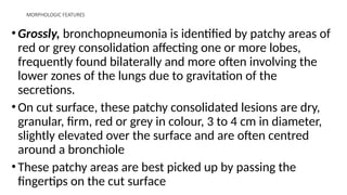 MORPHOLOGIC FEATURES
•Grossly, bronchopneumonia is identified by patchy areas of
red or grey consolidation affecting one or more lobes,
frequently found bilaterally and more often involving the
lower zones of the lungs due to gravitation of the
secretions.
•On cut surface, these patchy consolidated lesions are dry,
granular, firm, red or grey in colour, 3 to 4 cm in diameter,
slightly elevated over the surface and are often centred
around a bronchiole
•These patchy areas are best picked up by passing the
fingertips on the cut surface
 