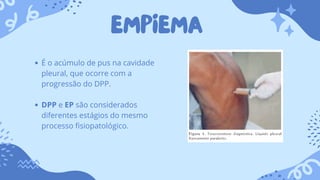 EMPIEMA
É o acúmulo de pus na cavidade
pleural, que ocorre com a
progressão do DPP.
DPP e EP são considerados
diferentes estágios do mesmo
processo fisiopatológico.
 