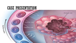 pneumonia in adults. causes, epidemiology, clinical presentation and ...