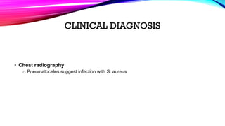 Pneumonia - Community Acquired Pneumonia (CAP) | PDF