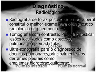 Diagnóstico
Radiológico
 Radiografia de torax póstero-anterior e perfil
constitui o melhor exame para o diagnóstico
radiológico da pneumonia.
 Tomografia com contraste: Para diagnosticar
lesões localizadas,como abscesso
pulmonar,empiema,fístulas.
 Ultra-sonografia para o diagnóstico de
doenças pulmonares,principalmente dos
derrames pleurais como
empiemas,hidrotórax,quilotórax.
 