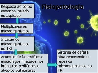 FisiopatologiaResposta ao corpo
estranho inalado
ou aspirado.
Multiplica-se os
microorganismos
Invasão de
microorganismos
no TRI
Acumulo de Neutrófilos e
macrófagos imaturos nos
brônquios periféricos e
alvéolos pulmonares.
Sistema de defesa
atua removendo e
repeli os
microorganismos no
TR.
 
