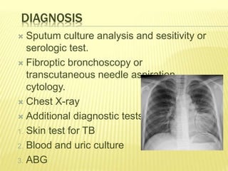 DIAGNOSIS
 Sputum culture analysis and sesitivity or
serologic test.
 Fibroptic bronchoscopy or
transcutaneous needle aspiration
cytology.
 Chest X-ray
 Additional diagnostic tests-
1. Skin test for TB
2. Blood and uric culture
3. ABG
 