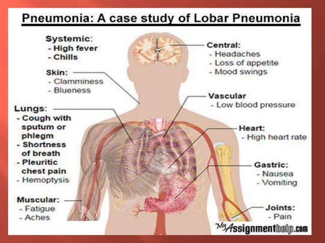 case study lobar pneumonia