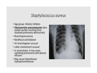 PNEUMONIA A CLINICAL APPROACH AND MANAGEMENT | PPTX