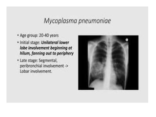 PNEUMONIA A CLINICAL APPROACH AND MANAGEMENT | PPTX