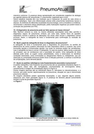 interstício pulmonar. A presença dessa apresentação era considerada sugestiva de etiologia
por agentes atípicos (M. pneumoniae, C. pneumoniae, Legionella spp e vírus)
Vários trabalhos recentes têm nos mostrado que é impossível, do ponto de vista clínico e
mesmo radiológico, fazer uma diferenciação precisa entre pneumonias bacterianas típicas e
atípicas. As diretrizes de diferentes sociedades de pneumologia, como a brasileira e a britânica,
recomendam o abandono dessa classificação, pelas implicações negativas que podem trazer à
condução dos pacientes com PAC.

15 - O diagnóstico de pneumonia pode ser feito apenas em bases clínicas?
Não. Nenhum sintoma ou sinal, ou mesmo diferentes associações entre eles, permite o
diagnóstico seguro de pneumonia, embora, por outro lado, exame físico do aparelho
respiratório normal e ausência de alterações nos sinais vitais tornem o diagnóstico menos
provável. Assim, a radiografia de tórax é fundamental para confirmação ou exclusão de
pneumonia.

16 - Qual o papel da radiografia de tórax no diagnóstico da pneumonia?
A radiografia de tórax é fundamental para o diagnóstico de pneumonia, no sentido de
diferenciá-la de outros quadros infecciosos do trato respiratório inferior e superior, tais como
bronquites agudas e rinossinusites agudas, nos quais os sintomas podem ser semelhantes,
mas a radiografia de tórax é normal. A radiografia, no caso de positiva, define ainda a extensão
do processo, que se correlaciona com a gravidade do quadro. Uma radiografia de tórax
alterada pode ainda: a) sugerir outras possibilidades, como a tuberculose; b) identificar
condições associadas, como tumorações ou alargamentos hilares ou mediastinais, que por
obstrução ou compressão brônquica podem levar à infecção pulmonar; c) verificar a ocorrência
de complicações, como derrame pleural.

17 - Quais os padrões radiológicos mais freqüentemente associados à pneumonia?
O padrão radiográfico mais freqüente nas pneumonias são as opacidades alveolares (figura 1).
Em alguns casos elas são homogêneas, acompanhadas de broncograma aéreo,
caracterizando a imagem de consolidação (figura 2 e figura 3).
Outras imagens descritas são as intersticiais (figura 4), reticulares ou reticulonodulares, e a
tumoral, que pode ocorrer caprichosamente na pneumonia, situação em que é denominada
pneumonia redonda.
As imagens alveolares podem apresentar escavações, o que, segundo alguns autores,
associa-se com maior gravidade (figura 5). A presença de derrame pleural concomitante
também é sinal de gravidade (figura 6).
»» Figura 1
                                Radiografia de tórax em PA




   Radiografia de tórax em PA com opacificação alveolar não homogênea no terço médio do
                               campo pleuro-pulmonar direito.

                                                                           www.pneumoatual.com.br
                                                                                  ISSN 1519-521X
 
