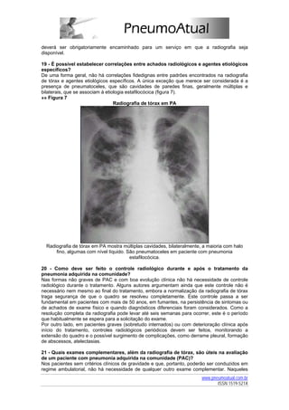 deverá ser obrigatoriamente encaminhado para um serviço em que a radiografia seja
disponível.

19 - É possível estabelecer correlações entre achados radiológicos e agentes etiológicos
específicos?
De uma forma geral, não há correlações fidedignas entre padrões encontrados na radiografia
de tórax e agentes etiológicos específicos. A única exceção que merece ser considerada é a
presença de pneumatoceles, que são cavidades de paredes finas, geralmente múltiplas e
bilaterais, que se associam à etiologia estafilocócica (figura 7).
»» Figura 7
                                  Radiografia de tórax em PA




  Radiografia de tórax em PA mostra múltiplas cavidades, bilateralmente, a maioria com halo
      fino, algumas com nível líquido. São pneumatoceles em paciente com pneumonia
                                        estafilocócica.

20 - Como deve ser feito o controle radiológico durante e após o tratamento da
pneumonia adquirida na comunidade?
Nas formas não graves de PAC e com boa evolução clínica não há necessidade de controle
radiológico durante o tratamento. Alguns autores argumentam ainda que este controle não é
necessário nem mesmo ao final do tratamento, embora a normalização da radiografia de tórax
traga segurança de que o quadro se resolveu completamente. Este controle passa a ser
fundamental em pacientes com mais de 50 anos, em fumantes, na persistência de sintomas ou
de achados de exame físico e quando diagnósticos diferenciais foram considerados. Como a
resolução completa da radiografia pode levar até seis semanas para ocorrer, este é o período
que habitualmente se espera para a solicitação do exame.
Por outro lado, em pacientes graves (sobretudo internados) ou com deterioração clínica após
início do tratamento, controles radiológicos periódicos devem ser feitos, monitorando a
extensão do quadro e o possível surgimento de complicações, como derrame pleural, formação
de abscessos, atelectasias.

21 - Quais exames complementares, além da radiografia de tórax, são úteis na avaliação
de um paciente com pneumonia adquirida na comunidade (PAC)?
Nos pacientes sem critérios clínicos de gravidade e que, portanto, poderão ser conduzidos em
regime ambulatorial, não há necessidade de qualquer outro exame complementar. Naqueles
                                                                        www.pneumoatual.com.br
                                                                               ISSN 1519-521X
 