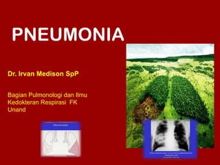 Dr. Irvan Medison SpP
Bagian Pulmonologi dan Ilmu
Kedokteran Respirasi FK
Unand
PNEUMONIA
 