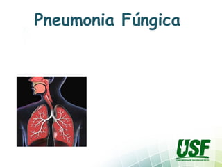 Pneumonia Fúngica  