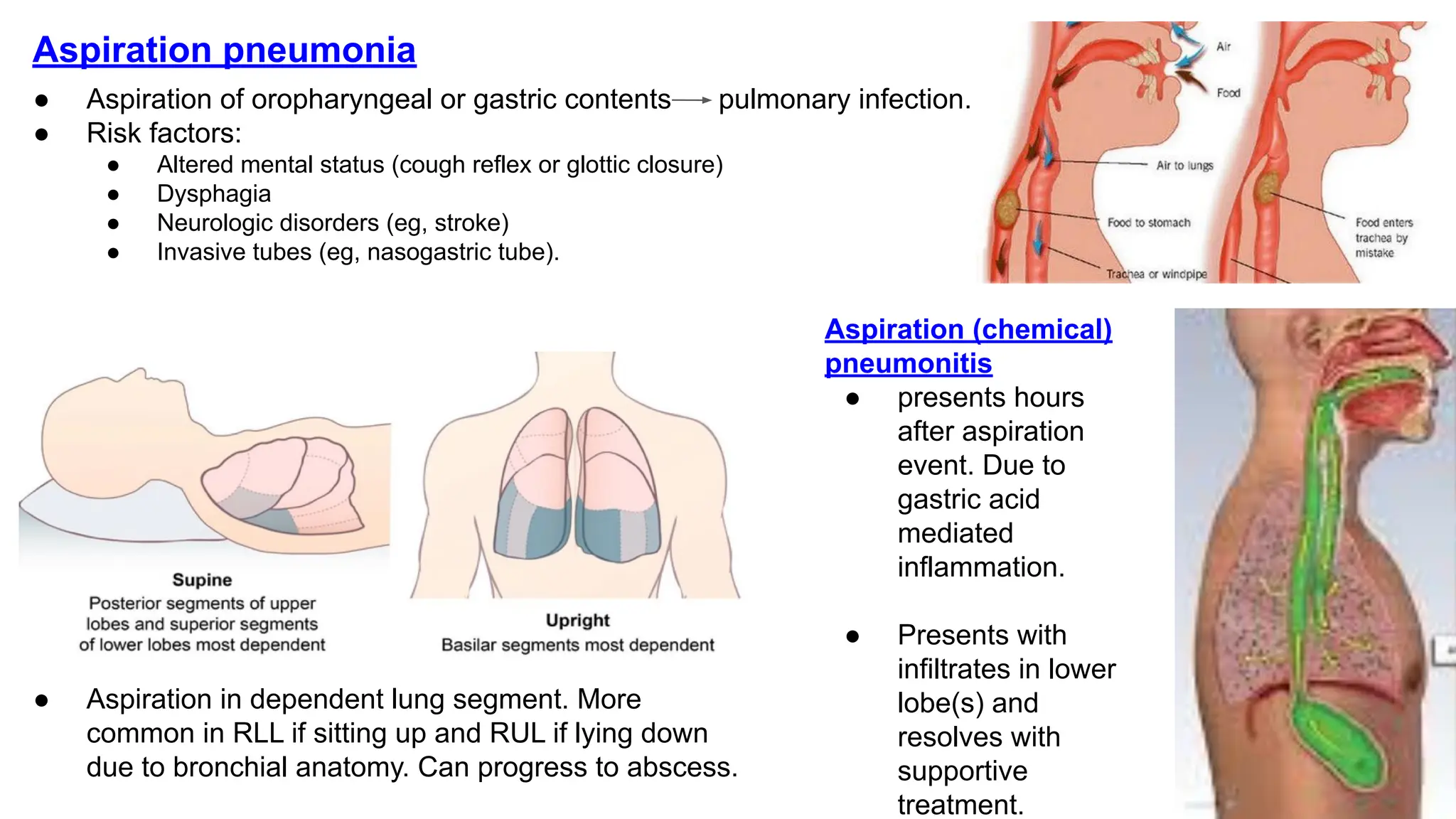 Pneumonia in children.pdf Pediatric presentation | PDF