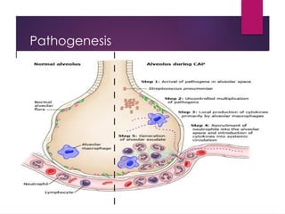 Pathogenesis
 