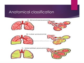 Anatomical classification
 