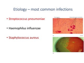 Etiology – most common infections
• Streptococcus pneumoniae
• Haemophilus influenzae
• Staphylococcus aureus
 