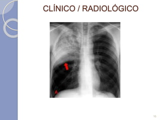 CLÍNICO / RADIOLÓGICO
10
 