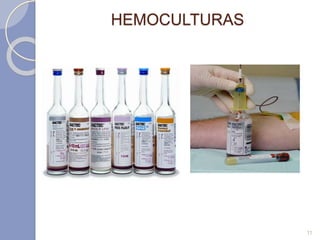 HEMOCULTURAS
11
 