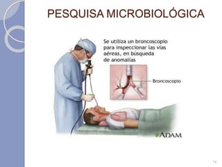 PESQUISA MICROBIOLÓGICA
14
 