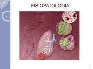 FISIOPATOLOGIA
6
 