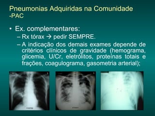 Pneumonias Adquiridas na Comunidade  -PAC Ex. complementares:  Rx tórax    pedir SEMPRE.  A indicação dos demais exames depende de critérios clínicos de gravidade (hemograma, glicemia, U/Cr, eletrólitos, proteínas totais e frações, coagulograma, gasometria arterial);   