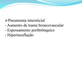 Ø Pneumonia intersticial
- Aumento da trama broncovascular
- Espessamento peribrônquico
- Hiperinsuflação
 