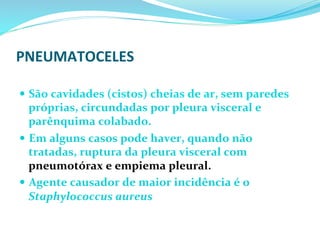 PNEUMATOCELES	
  
	
  	
  
—  São	
  cavidades	
  (cistos)	
  cheias	
  de	
  ar,	
  sem	
  paredes	
  
próprias,	
  circundadas	
  por	
  pleura	
  visceral	
  e	
  
parênquima	
  colabado.	
  
—  Em	
  alguns	
  casos	
  pode	
  haver,	
  quando	
  não	
  
tratadas,	
  ruptura	
  da	
  pleura	
  visceral	
  com	
  
pneumotórax	
  e	
  empiema	
  pleural.	
  
—  Agente	
  causador	
  de	
  maior	
  incidência	
  é	
  o	
  
Staphylococcus	
  aureus	
  	
  
	
  
 