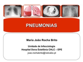 Maria João Rocha Brito
Unidade de Infecciologia
Hospital Dona Estefânia CHLC – EPE
joao.rochabrito@netcabo.pt
PNEUMONIAS
PNEUMONIAS
 