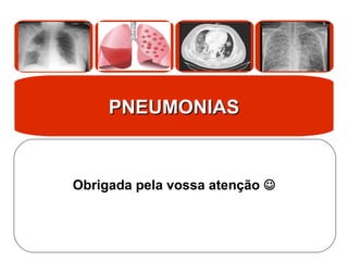 PNEUMONIAS
PNEUMONIAS
Obrigada pela vossa atenção 
 