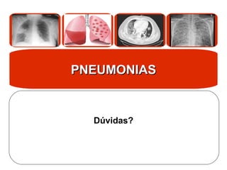 PNEUMONIAS
PNEUMONIAS
Dúvidas?
 