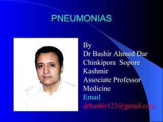 PNEUMONIAS By  Dr Bashir Ahmed Dar Chinkipora  Sopore Kashmir Associate Professor Medicine Email  [email_address] 